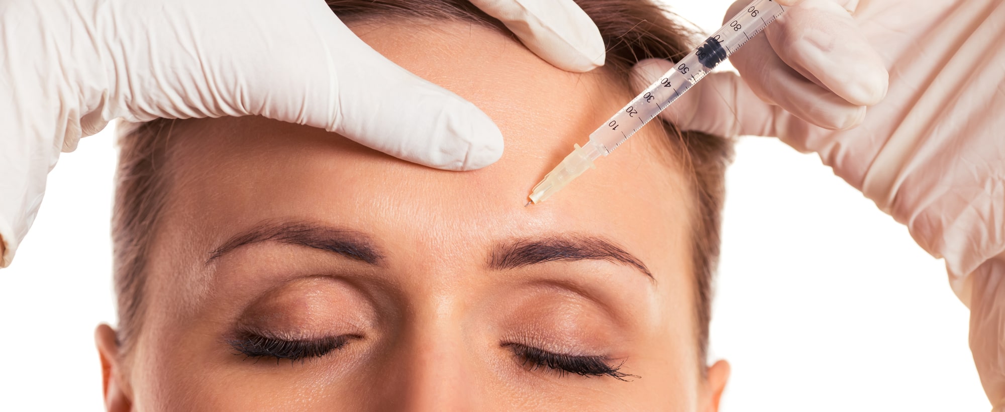 Injections de Botox® à Toulouse